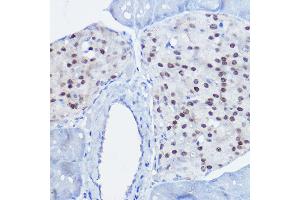Immunohistochemistry of paraffin-embedded mouse pancreas using NKX6-1 antibody (ABIN7268929) at dilution of 1:50 (40x lens).