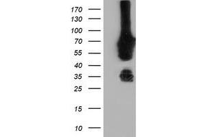 Western Blotting (WB) image for anti-N-Myristoyltransferase 2 (NMT2) antibody (ABIN1499781) (NMT2 antibody)