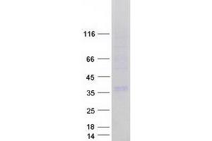 Western Blotting (WB) image for Gap Junction Protein, beta 3, 31kDa (GJB3) (Transcript Variant 2) protein (Myc-DYKDDDDK Tag) (ABIN2721891)