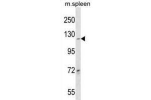 Western Blotting (WB) image for anti-Collagen, Type XIX, alpha 1 (COL19A1) antibody (ABIN3000558) (COL19A1 antibody)
