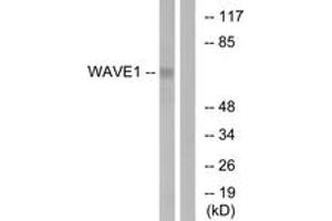 Western blot analysis of extracts from 293 cells, treated with insulin 0. (WASF1 antibody  (AA 91-140))