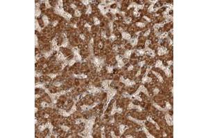 Immunohistochemical staining of human liver with C1orf26 polyclonal antibody  shows distinct cytoplasmic positivity in hepatocytes at 1:200-1:500 dilution. (SWT1 antibody)