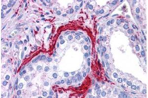 Human Prostate: Formalin-Fixed, Paraffin-Embedded (FFPE) (ATG5 antibody  (C-Term))