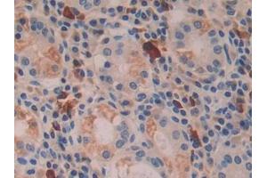 Immunohistochemistry (IHC) image for anti-Interferon, beta 1, Fibroblast (IFNB1) (AA 22-187) antibody (ABIN7431356)