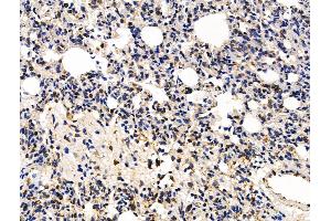 ABIN7094542 and ABIN7098591 at 1/100 staining Rat lung tissue by IHC-P.