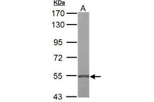 WB Image UGDH antibody detects UGDH protein by Western blot analysis. (UGDH antibody)