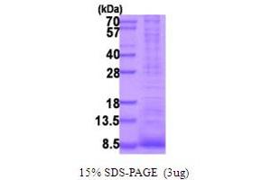 SDS-PAGE (SDS) image for Epiregulin (EREG) (AA 63-108) protein (His tag) (ABIN5854023)