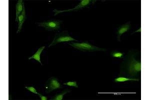 Immunofluorescence of purified MaxPab antibody to FANCL on HeLa cell. (FANCL antibody  (AA 1-375))