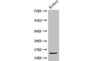 Western Blot Positive WB detected in: Mouse kidney tissue All lanes: MPC2 antibody at 3.