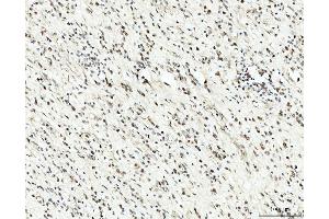 IHC analysis of RRP4/EXOSC2 using anti-RRP4/EXOSC2 antibody (ABIN7602188). (EXOSC2 antibody  (AA 62-293))