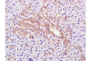 Paraformaldehyde-fixed, paraffin embedded Rat liver; Antigen retrieval by boiling in sodium citrate buffer (pH6. (RNF213 antibody  (AA 4750-4800))