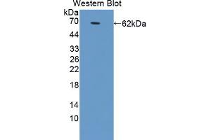 Western blot analysis of the recombinant protein. (GRIA2 antibody  (AA 25-543))