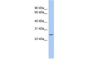 LYPD5 antibody used at 1 ug/ml to detect target protein. (LYPD5 antibody  (N-Term))