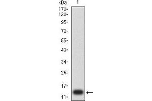 Western blot analysis using CD203C mAb against human CD203C (AA: extra 45-163) recombinant protein. (ENPP3 antibody  (AA 45-163))