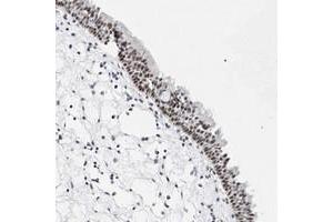 Immunohistochemical staining of human nasopharynx with VEZF1 polyclonal antibody  shows moderate nuclear positivity in respiratory epithelial cells at 1:10-1:20 dilution. (VEZF1 antibody)
