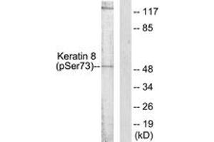 Western blot analysis of extracts from 293 cells treated with Etoposide 25uM 60', using Keratin 8 (Phospho-Ser73) Antibody. (KRT8 antibody  (pSer73))