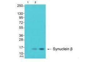 Western blot analysis of extracts from 293 cells (Lane 2) and cos-7 cells (Lane 3), using Synuclein β antiobdy.