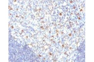 IHC analysis of FFPE human tonsil tissue and IgM antibody (MuHC2) (Mouse anti-Human IgM Antibody)