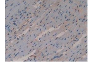 Detection of GSTo1 in Mouse Heart Tissue using Polyclonal Antibody to Glutathione S Transferase Omega 1 (GSTo1) (GSTO1 antibody  (AA 24-233))