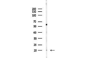 Western blot analysis of lysates from MDA-MB-231 cells, using UBE2T Antibody at 1/1000 dilution.