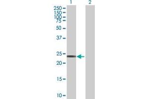 Western Blot analysis of RPE expression in transfected 293T cell line by RPE MaxPab polyclonal antibody. (RPE antibody  (AA 1-228))