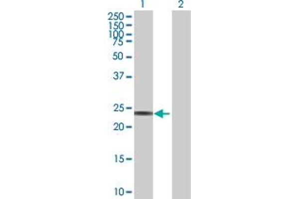 RPE anticorps  (AA 1-228)