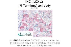 Image no. 1 for anti-Lysyl Oxidase-Like 2 (LOXL2) (N-Term) antibody (ABIN1736517) (LOXL2 antibody  (N-Term))