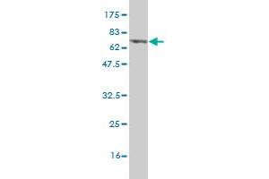 Western Blot detection against Immunogen (70. (PHKG2 antibody  (AA 1-406))
