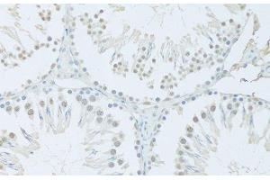 Immunohistochemistry of paraffin-embedded Rat testis using FIP1L1 Polyclonal Antibody at dilution of 1:100 (20x lens). (FIP1L1 antibody)