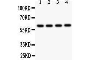 Observed bind size: 60KD (CADM1 antibody  (AA 45-340))