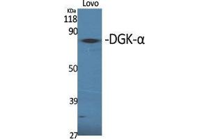 Western Blot (WB) analysis of specific cells using DGK-alpha Polyclonal Antibody. (DGKA antibody  (Internal Region))