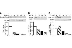 Western Blotting (WB) image for anti-COL1A2/COL1A1 antibody (ABIN5596819)