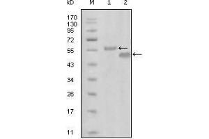 Western blot analysis using EphA6 mouse mAb against truncated MBP-EphA6 recombinant protein (1) and truncated GST-EphA6(aa695-795) recombinant protein (2). (EPH Receptor A6 antibody  (AA 695-795))