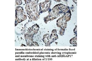 Image no. 1 for anti-rho GTPase Activating Protein 17 (ARHGAP17) antibody (ABIN1574792) (ARHGAP17 antibody)
