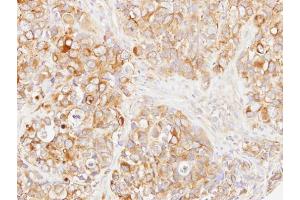 IHC-P Image Immunohistochemical analysis of paraffin-embedded H661 xenograft, using DOK1, antibody at 1:500 dilution. (DOK1 antibody)