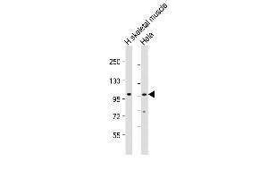 All lanes : Anti-ATXN2 Antibody (Center) at 1:2000 dilution Lane 1: human skeletal muscle lysate Lane 2: Hela whole cell lysate Lysates/proteins at 20 μg per lane. (Ataxin 2 antibody  (AA 725-757))