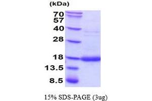 Colony Stimulating Factor 3 (Granulocyte) (CSF3) (AA 31-204) (Active) protein