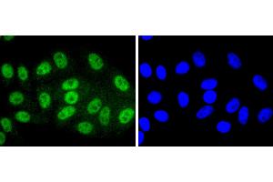 HepG2 cells were stained with SIRT1(T530) (6H5) Monoclonal Antibody  at [1:200] incubated overnight at 4C, followed by secondary antibody incubation, DAPI staining of the nuclei and detection. (SIRT1 antibody  (pThr530))
