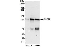 anti-Calcium Homeostasis Endoplasmic Reticulum Protein (CHERP) (AA 400-450) antibody