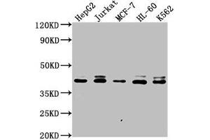 Western Blot Positive WB detected in: HepG2 whole cell lysate, Jurkat whole cell lysate, MCF-7 whole cell lysate, HL-60 whole cell lysate, K562 whole cell lysate All lanes: LSM11 antibody at 1:2000 Secondary Goat polyclonal to rabbit IgG at 1/50000 dilution Predicted band size: 40 kDa Observed band size: 40 kDa (LSM11 antibody  (AA 1-141))