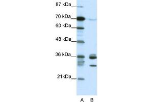 WB Suggested Anti-CDK5 Antibody Titration:  1. (CDK5 antibody  (C-Term))