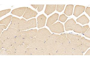 Detection of TNNT2 in Porcine Skeletal muscle Tissue using Monoclonal Antibody to Troponin T Type 2, Cardiac (TNNT2) (Cardiac Troponin T2 antibody  (AA 1-295))