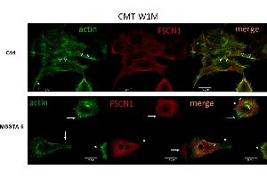 Representative confocal microscopy images of cytoskeletal protein F-actin and fascin 1 in CMT-W1M canine carcinoma cell line. (Fascin antibody  (pSer39))