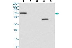 Western blot analysis of Lane 1: RT-4, Lane 2: U-251 MG, Lane 3: Human Plasma, Lane 4: Liver, Lane 5: Tonsil with LRRC40 polyclonal antibody  at 1:250-1:500 dilution. (LRRC40 antibody)