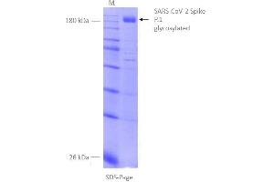SDS-Page of purified SPIKE in detergent mycelle. (SARS-CoV-2 Spike Protein (P.1 - gamma) (rho-1D4 tag))