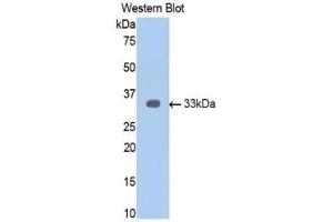 Detection of Recombinant AR, Human using Polyclonal Antibody to Androgen Receptor (AR) (Androgen Receptor antibody  (AA 15-246))