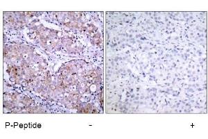 Image no. 1 for anti-Epidermal Growth Factor Receptor (EGFR) (pSer1070) antibody (ABIN196758) (EGFR antibody  (pSer1070))