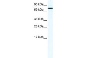 Western Blotting (WB) image for anti-Forkhead Box O6 (Foxo6) antibody (ABIN2461559) (Foxo6 antibody)