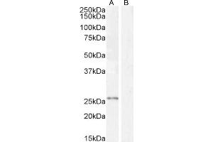Western Blotting (WB) image for anti-Kallikrein 2 (KLK2) (Internal Region) antibody (ABIN190842)