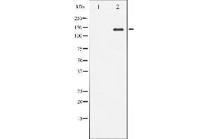 Western blot analysis of Bcr expression in HepG2 whole cell lysates,The lane on the left is treated with the antigen-specific peptide. (BCR antibody  (Internal Region))